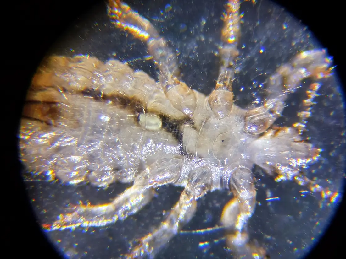 Chấy đầu (Pediculus humanus capitis)